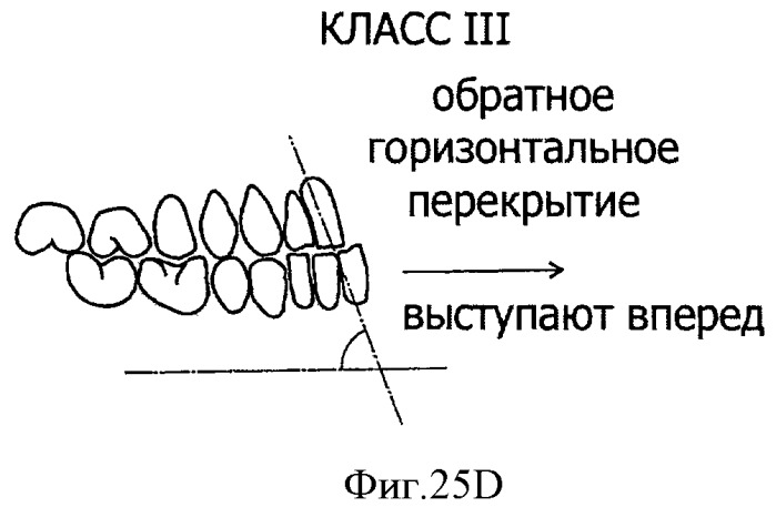 Зубные протезы, зубные дуги и способы их изготовления (патент 2510252)