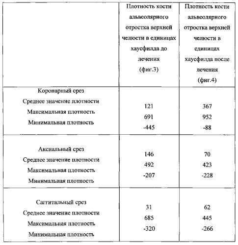 Способ восстановления тканей пародонта (патент 2558988)