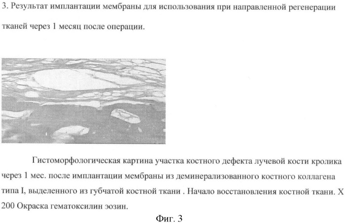 Мембрана для использования при направленной регенерации тканей (патент 2367475)