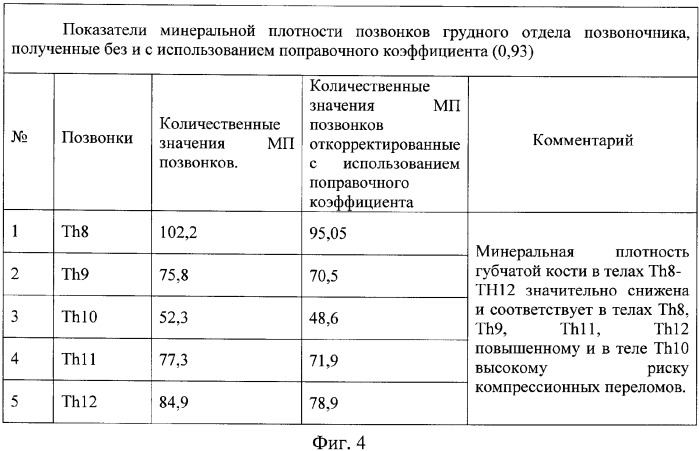 Способ определения риска остеопоротических переломов в грудном отделе позвоночника (патент 2376935)