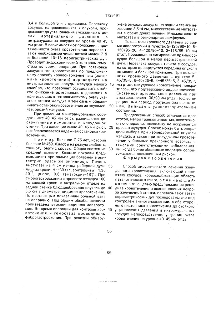 Способ хирургического лечения желудочного кровотечения (патент 1729491)