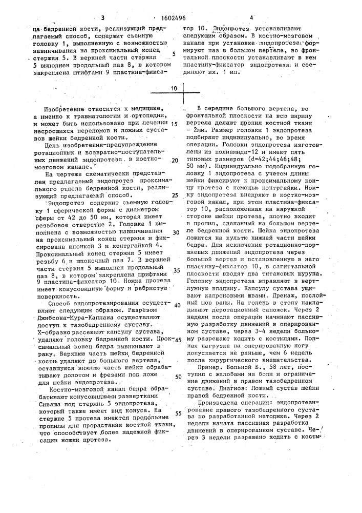 Способ эндопротезирования проксимального отдела бедренной кости и эндопротез проксимального отдела бедренной кости (патент 1602496)