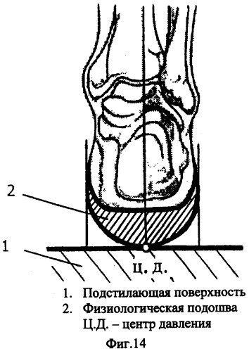 Способ и устройство для исправления дефектов стопы (патент 2301039)