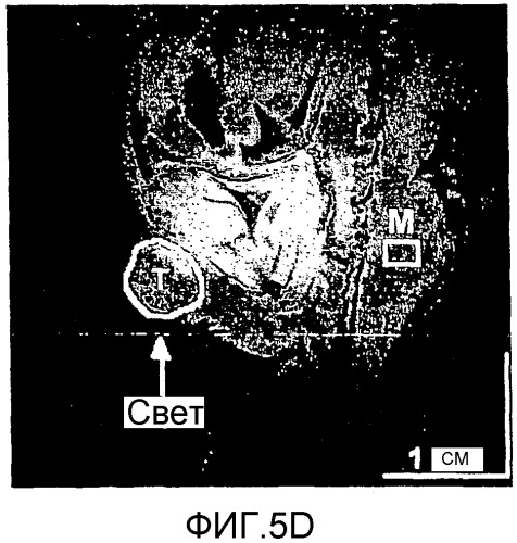 Сенсибилизированный оперативный bold-mri способ получения изображения (патент 2343829)