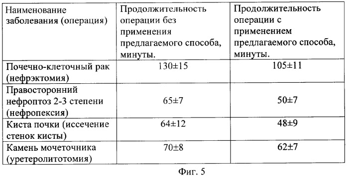 Способ определения мест оптимальной установки манипуляционных троакаров при лапароскопических операциях на органах забрюшинного пространства (патент 2338481)