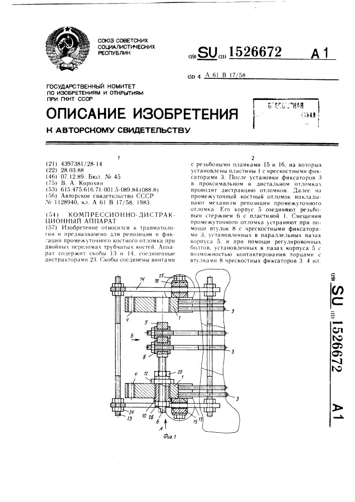 Компрессионно-дистракционный аппарат (патент 1526672)