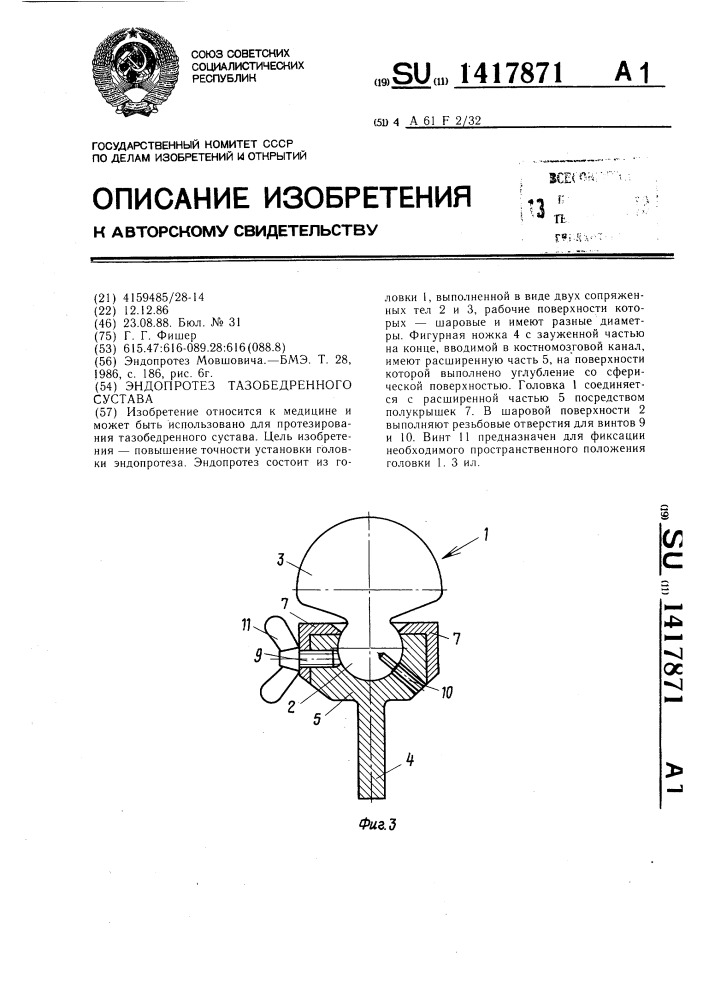 Эндопротез тазобедренного сустава (патент 1417871)