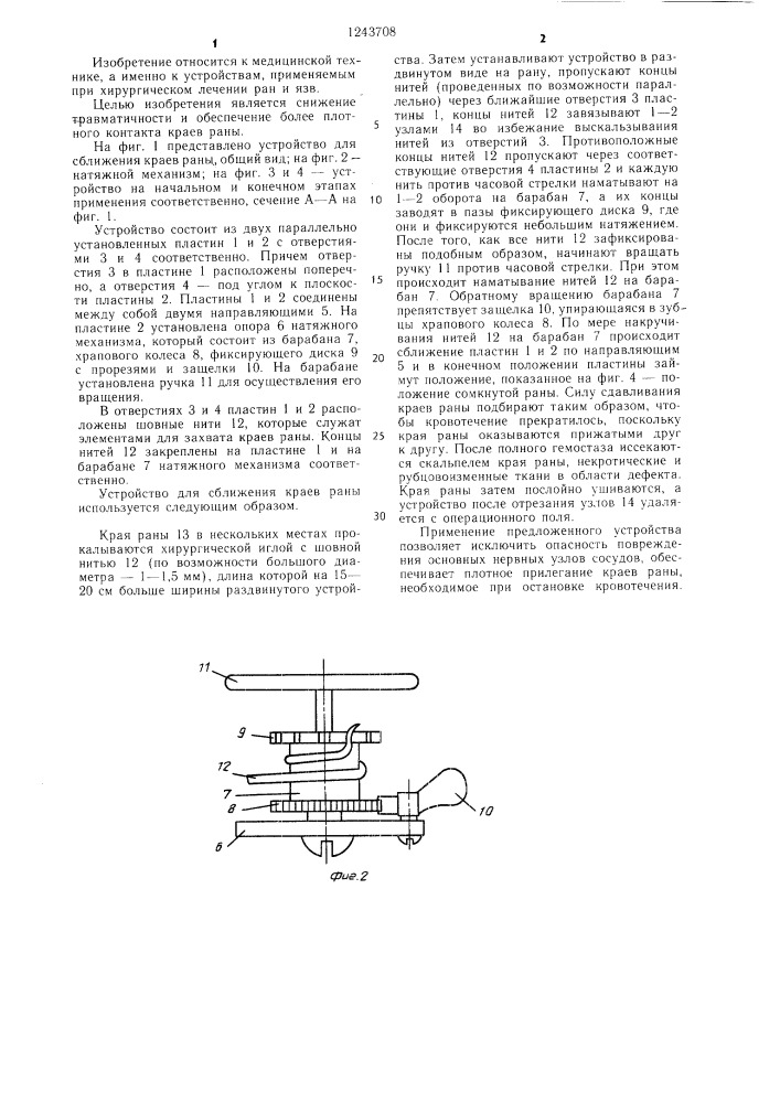 Устройство для сближения краев раны (патент 1243708)