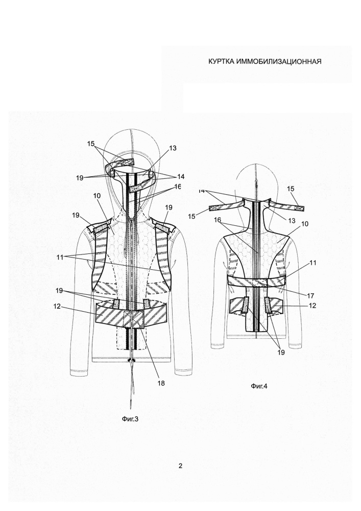 Куртка иммобилизационная (патент 2627206)