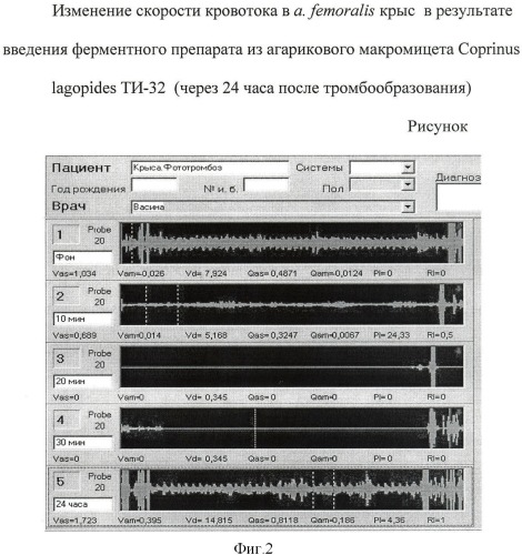 Ферментный препарат тромболитического и фибринолитического действия из базидиального гриба рода coprinus (патент 2435848)