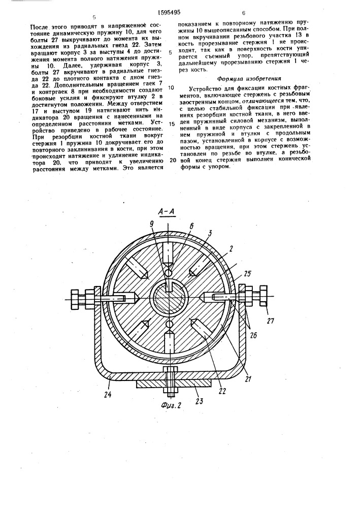 Устройство для фиксации костных фрагментов (патент 1595495)