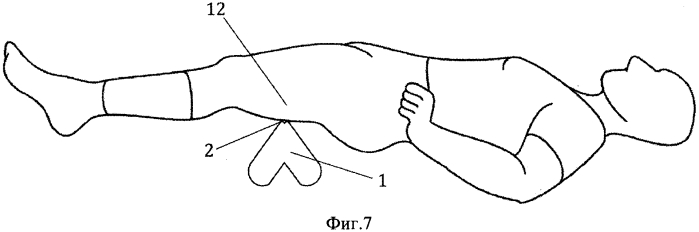 Способ самомассажа "дар-гора" и устройство для его осуществления "дубинушка" (патент 2549304)