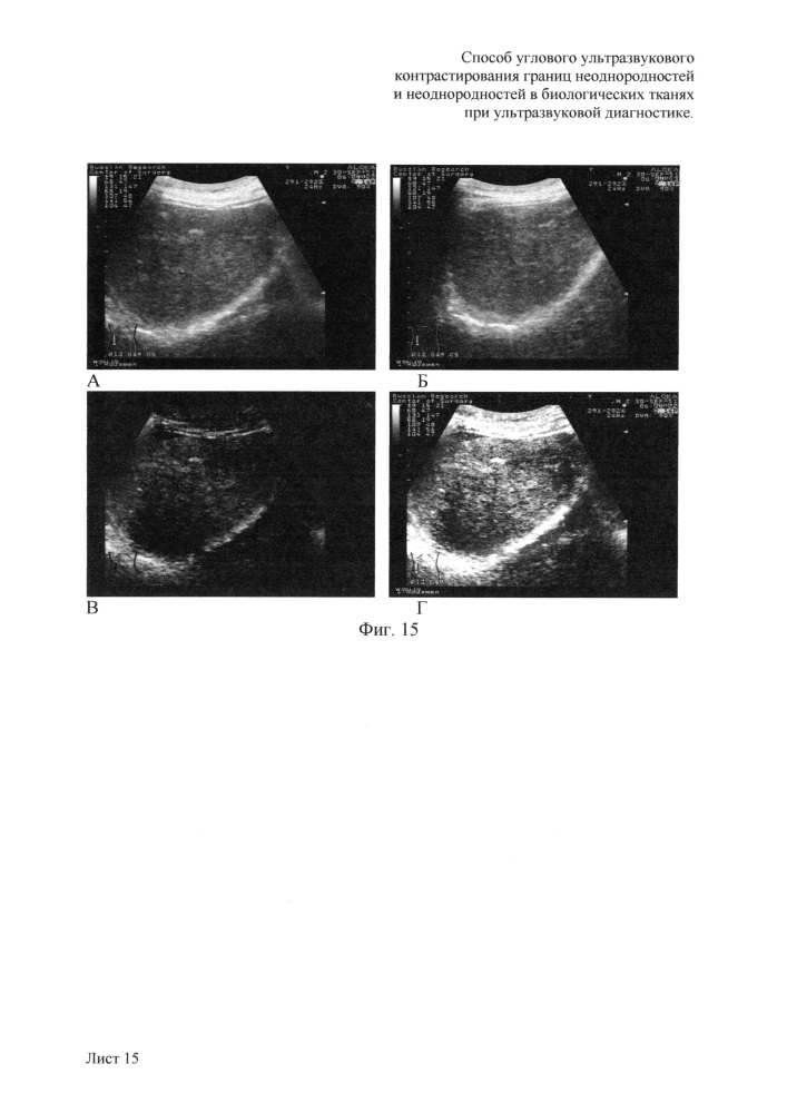 Способ углового ультразвукового контрастирования границ неоднородностей и неоднородностей в биологических тканях при ультразвуковой диагностике (патент 2648880)