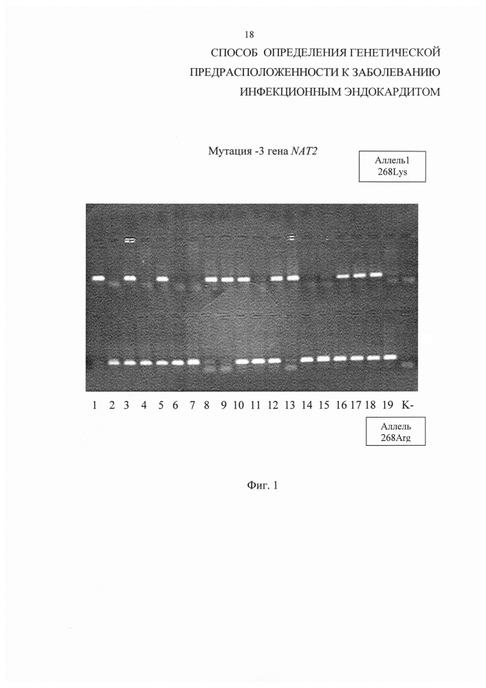 Способ определения генетической предрасположенности к заболеванию инфекционным эндокардитом (патент 2618459)