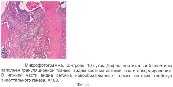 Гель для регенерации костной ткани (патент 2360663)