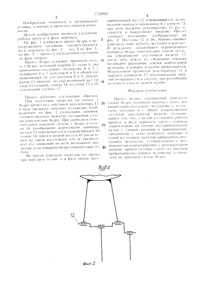 Протез бедра (патент 1532022)