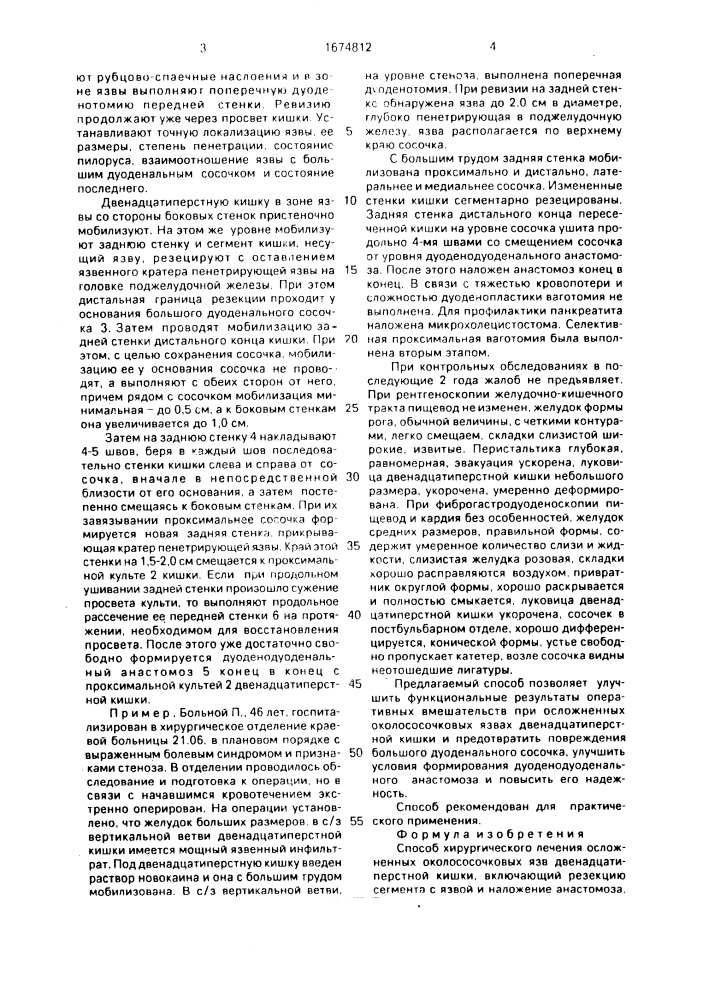 Способ хирургического лечения осложенных околососочковых язв двенадцатиперстной кишки (патент 1674812)