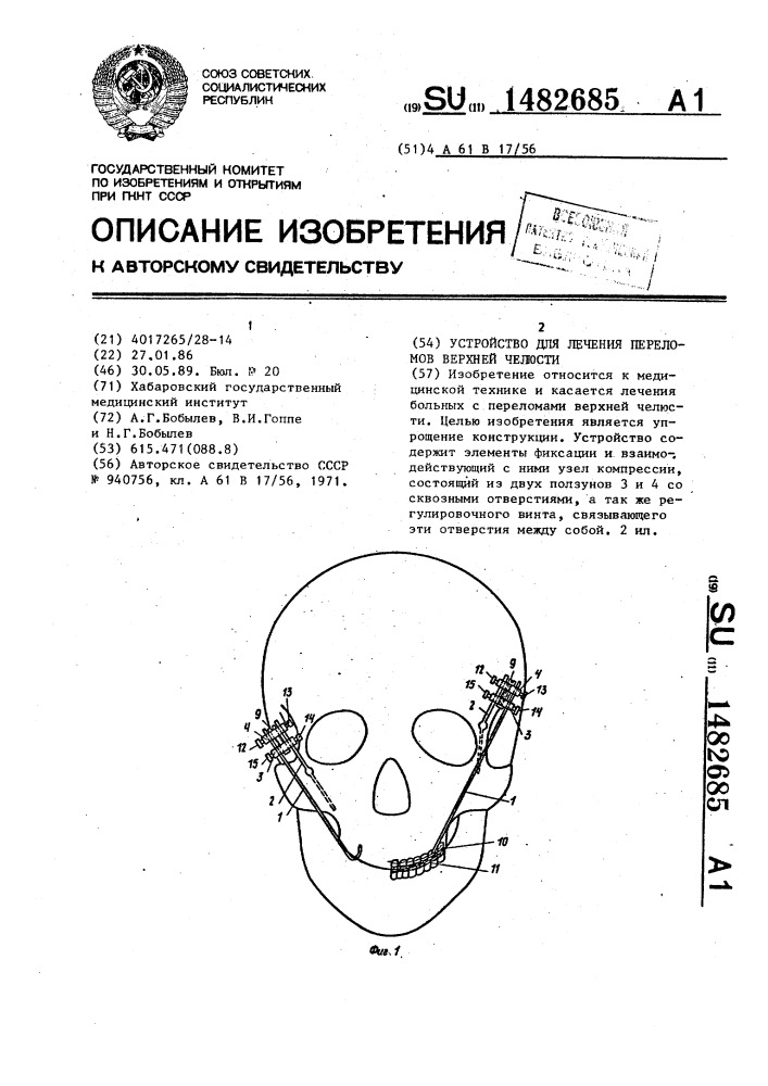 Устройство для лечения переломов верхней челюсти (патент 1482685)