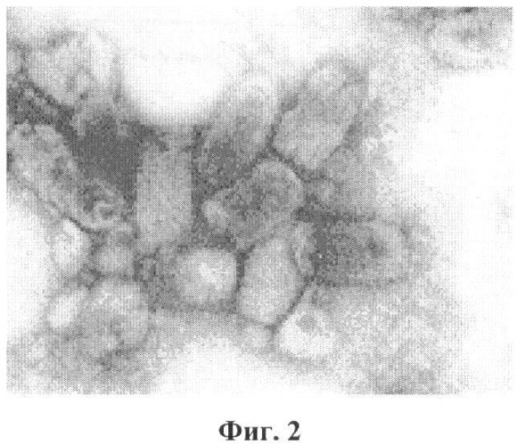 Штамм вируса эфемерной лихорадки крупного рогатого скота ephemerovirus bovinum для изготовления биопрепаратов для диагностики эфемерной лихорадки крупного рогатого скота (патент 2461391)