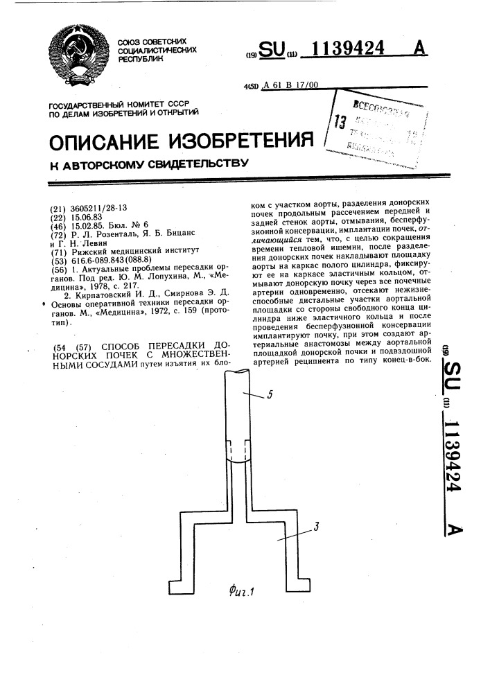 Способ пересадки донорских почек с множественными сосудами (патент 1139424)