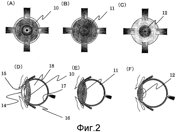 Кольцеобразное устройство (патент 2527353)