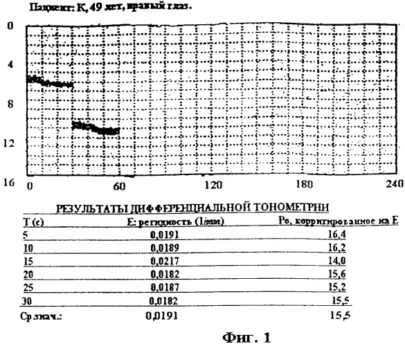 Способ дифференциальной тонометрии (патент 2314015)