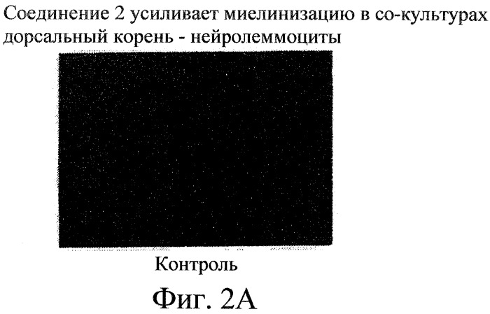 Производные пентадикарбоновой кислоты, фармацевтическая композиция на их основе и способы лечения (патент 2268881)
