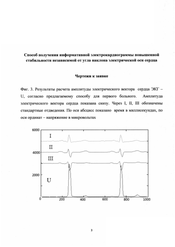 Способ получения информативной электрокардиограммы повышенной стабильности независимой от угла наклона электрической оси сердца (патент 2580976)