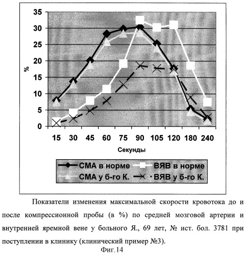 Способ диагностики ауторегуляции сосудов головного мозга (патент 2311133)