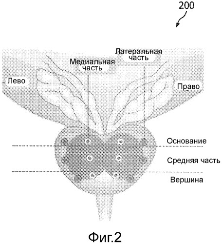 Способ и система для выполнения биопсии (патент 2510699)