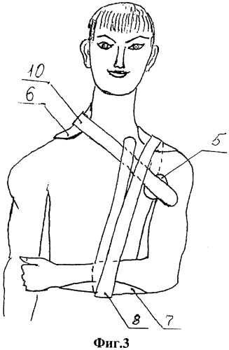 Медицинская транспортная шина для плечевого пояса (патент 2491039)