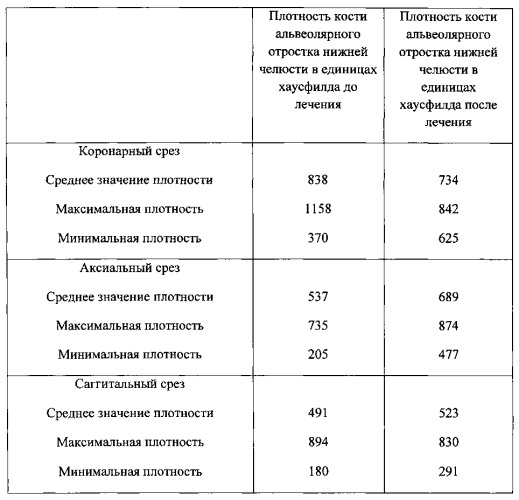 Способ восстановления тканей пародонта (патент 2558988)