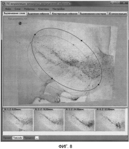 Автоматизированная система реконструкции 3d распределения нейронов по серии изображений срезов головного мозга (патент 2504012)