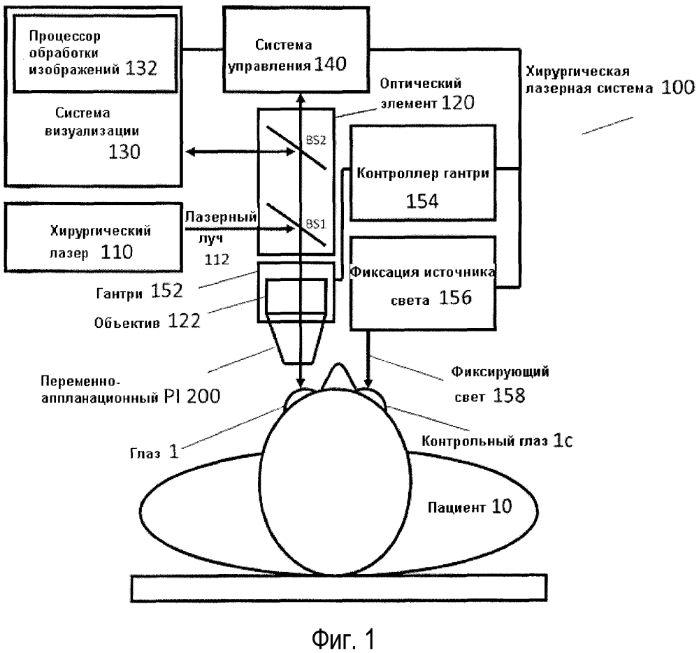 Интерфейс пациента с переменной аппланацией (патент 2621592)
