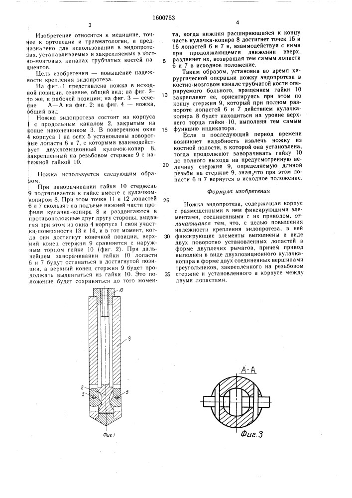 Ножка эндопротеза (патент 1600753)