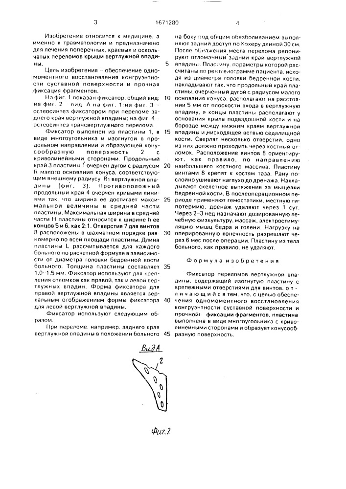Фиксатор переломов вертлужной впадины (патент 1671280)