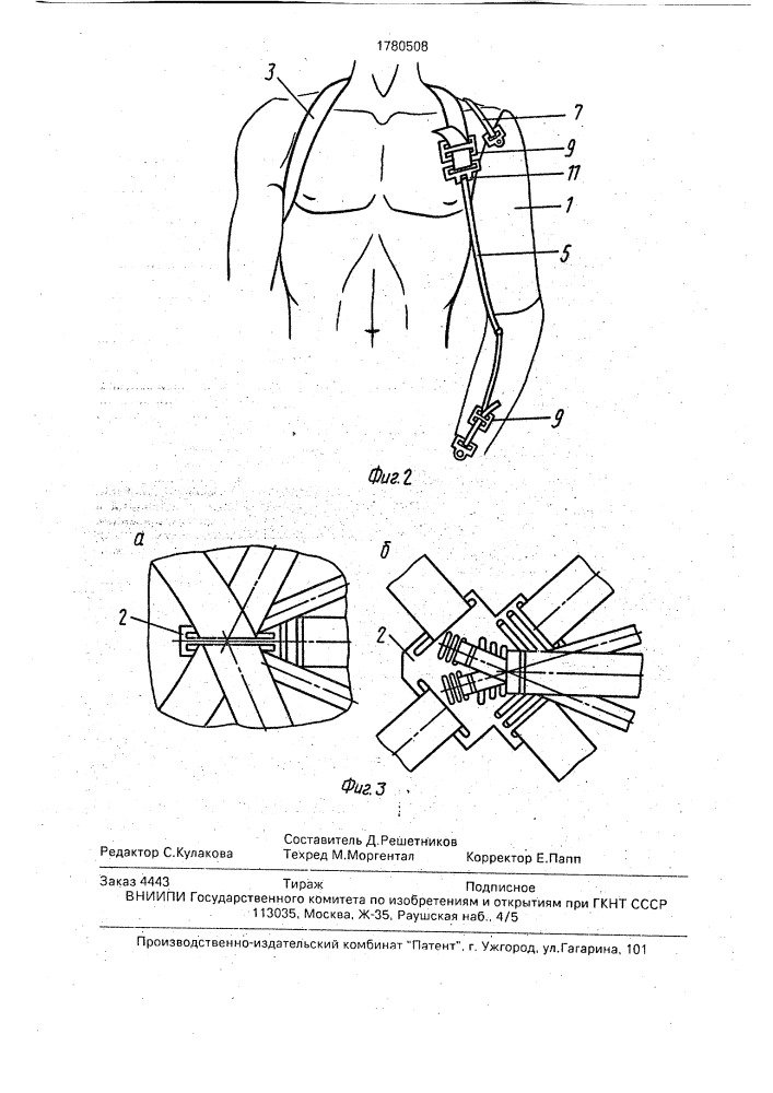 Крепление протеза верхней конечности (патент 1780508)