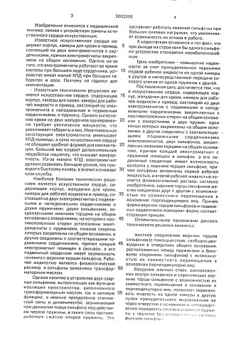 Искусственное сердце (патент 2003306)