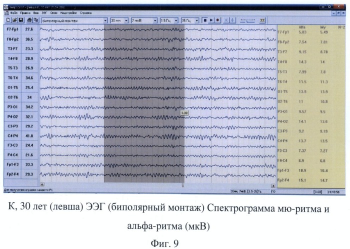 Способ диагностики функциональной межполушарной асимметрии у правшей и левшей (патент 2483672)