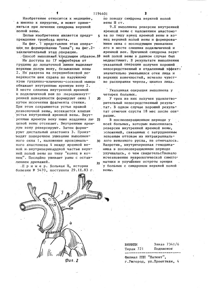 Способ лечения непроходимости верхней полой вены (патент 1194401)
