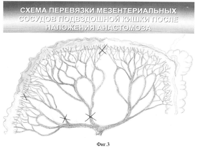 Способ изучения влияния большого сальника на повышение надежности кишечного анастомоза в эксперименте (патент 2364350)