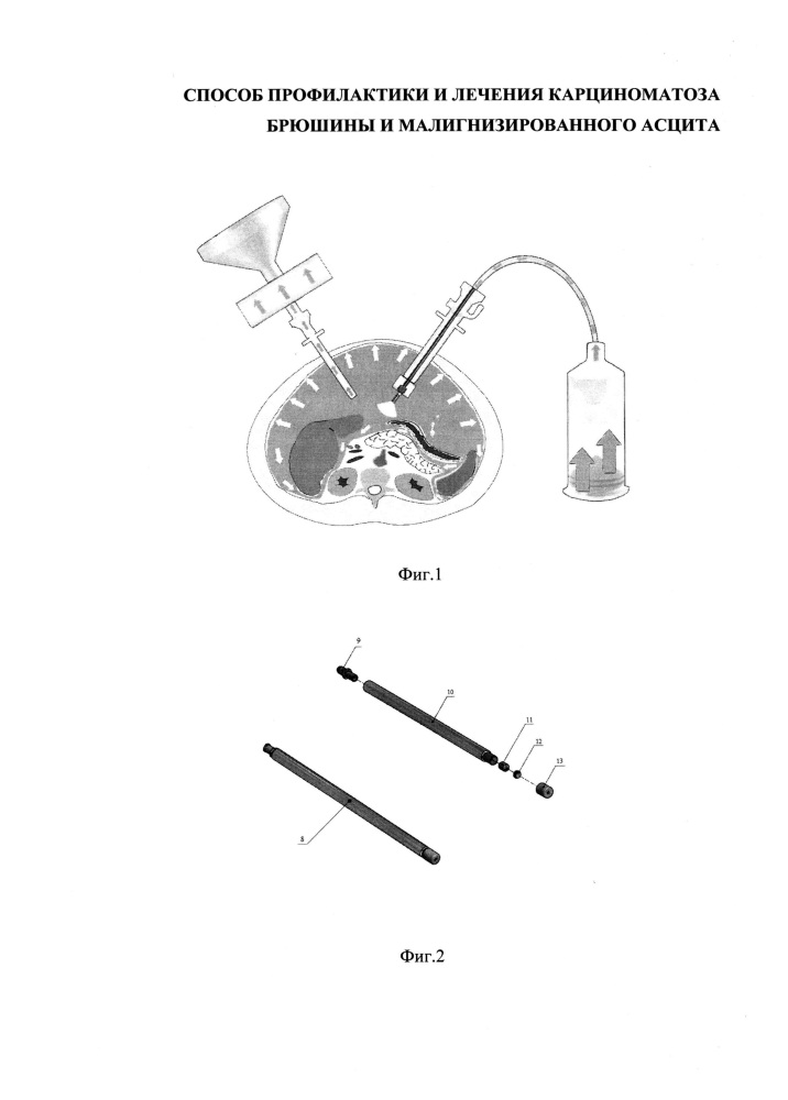 Способ профилактики и лечения карциноматоза брюшины и малигнизированного асцита (патент 2644311)
