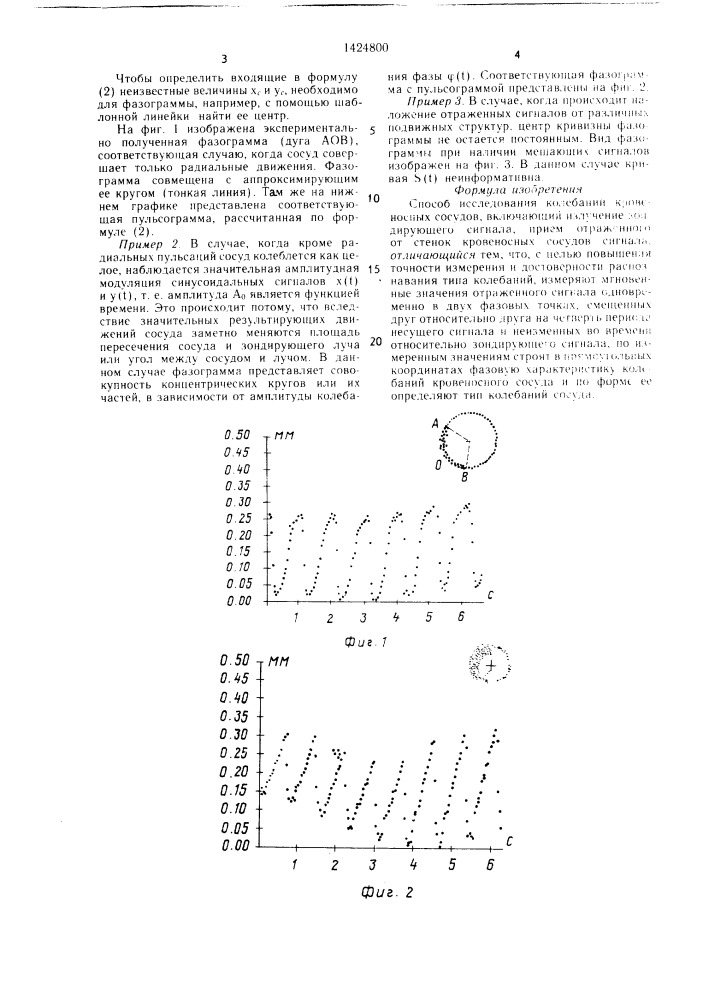 Способ исследования колебаний кровеносных сосудов (патент 1424800)