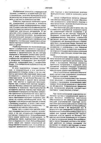 Эндопротез коленного сустава (патент 2001603)
