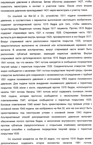 Способ лечения путем подкожной подачи пониженного давления с использованием разделения с помощью воздушного баллона (патент 2405588)