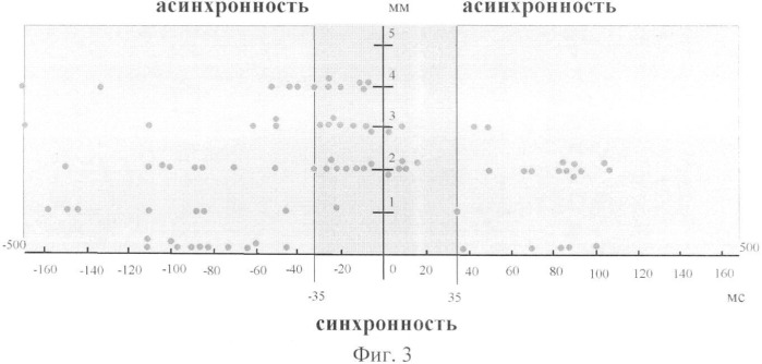 Способ диагностики и коррекции функционального состояния позвоночника (патент 2335239)
