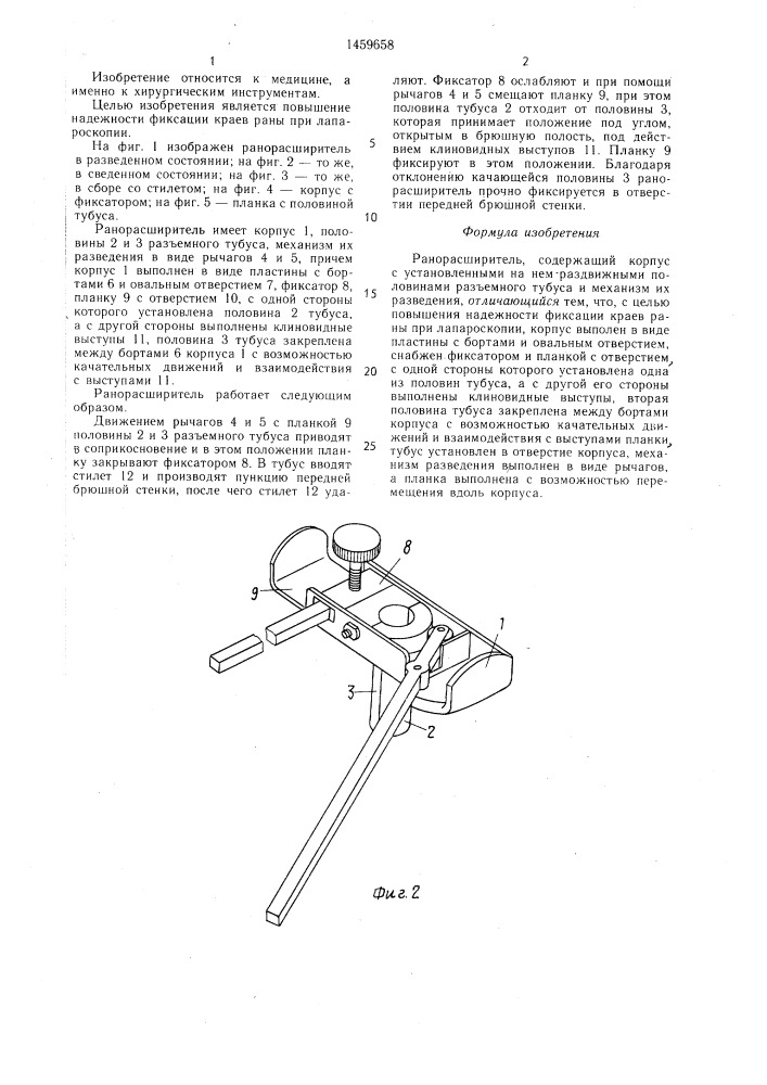 Ранорасширитель (патент 1459658)