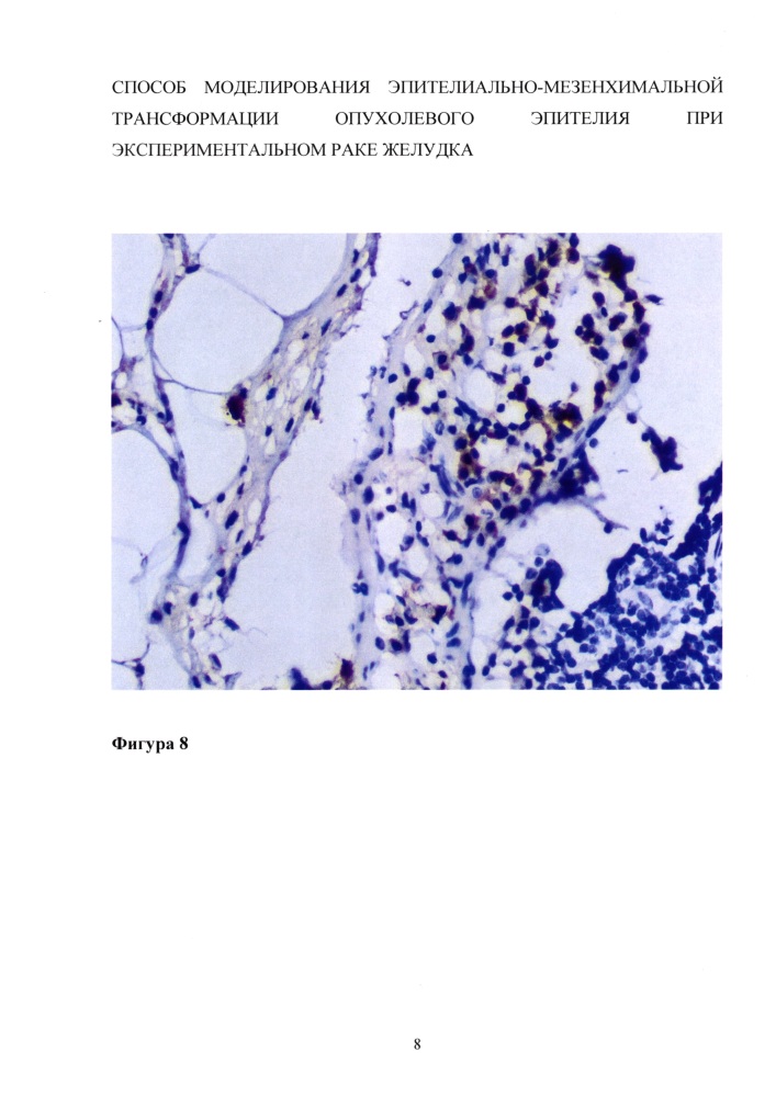 Способ моделирования эпителиально-мезенхимальной трансформации опухолевого эпителия при экспериментальном раке желудка (патент 2626717)