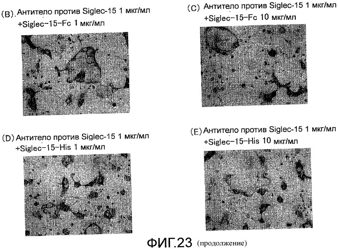 Антитело, направленное на белок siglec-15, связанный с остеокластами (патент 2475499)