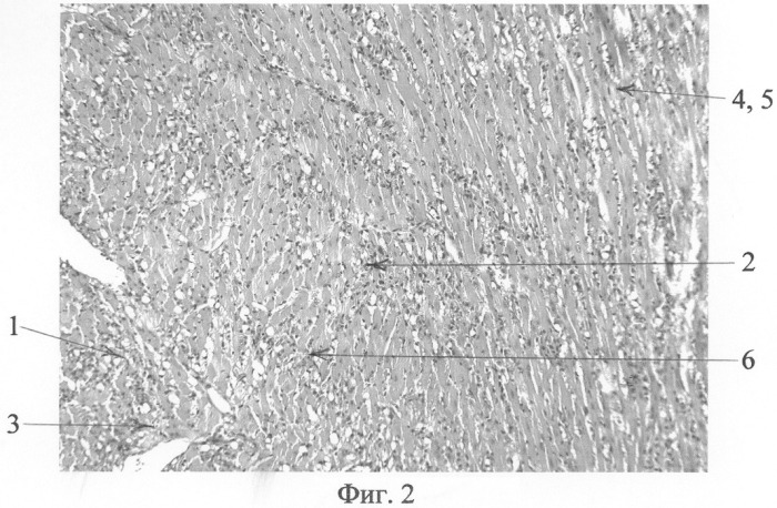 Способ моделирования очаговых повреждений миокарда (патент 2286606)